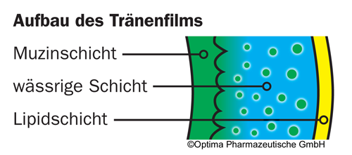 Aufbau Traenenfilm